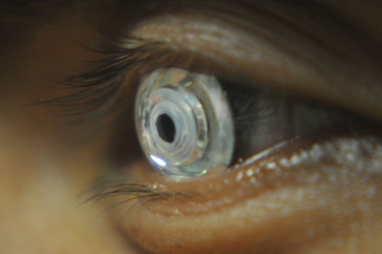 Cientistas criam lentes de contato que do zoom quando voc pisca duas vezes