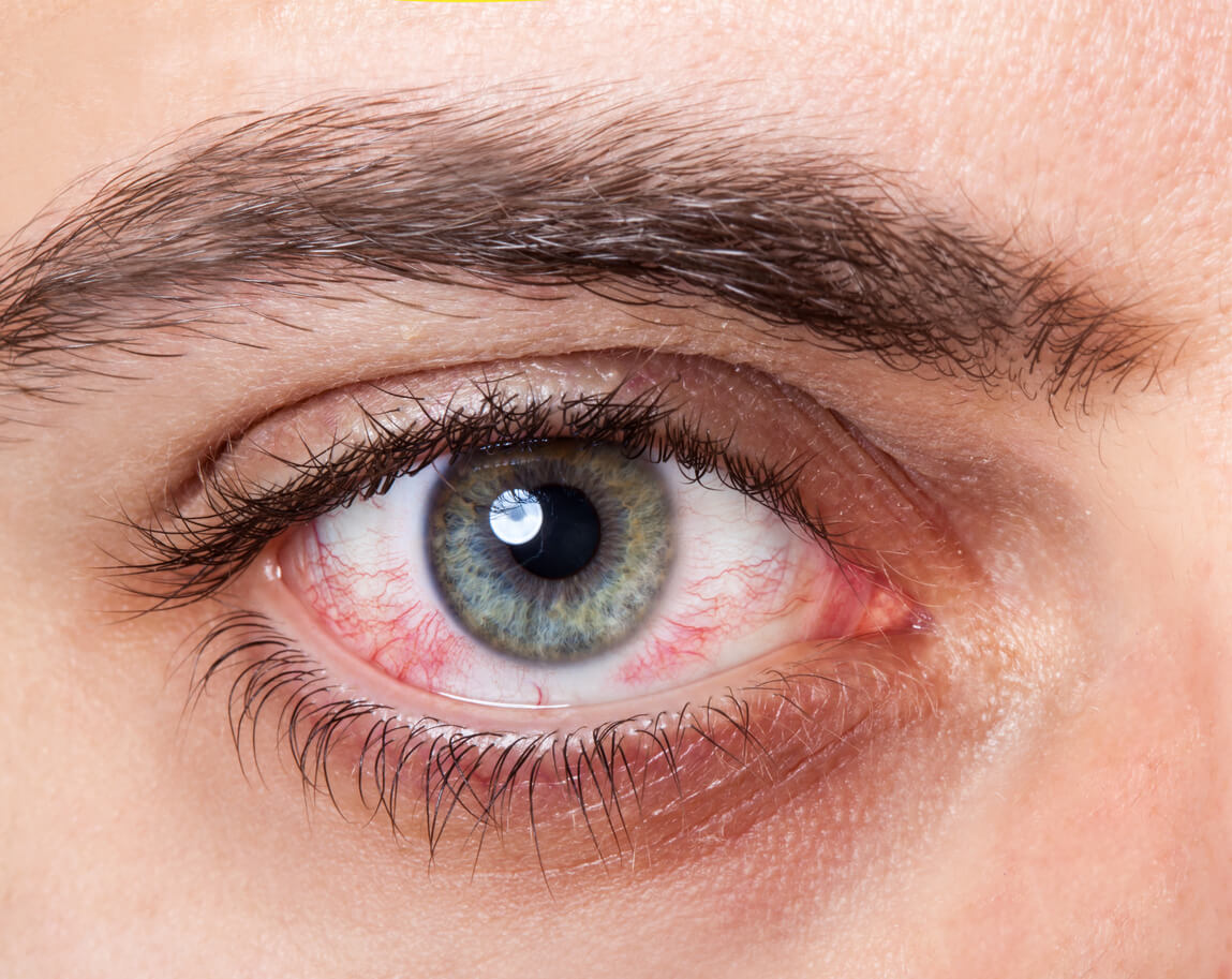 Cuidados com a sade ocular no inverno